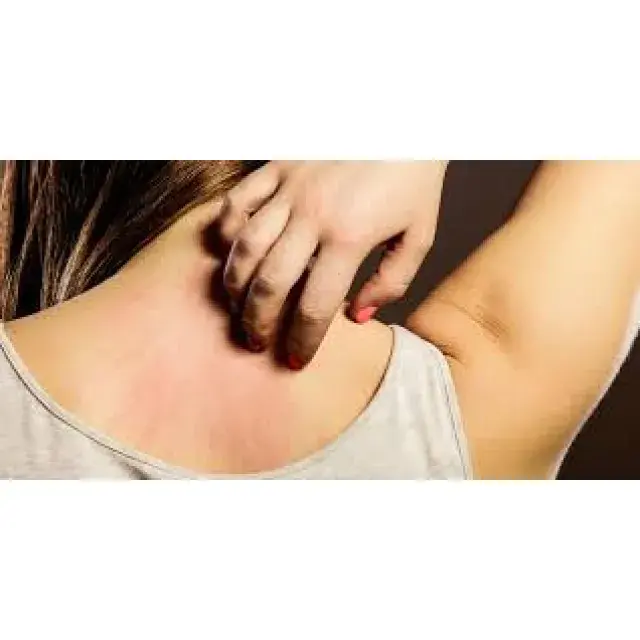 Stress Rash | Medical Seeds | Discount Cannabis Seeds